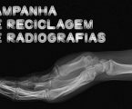 Campo Maior : 24ª  EDIÇÃO DA CAMPANHA DE RECOLHA DE RADIOGRAFIAS